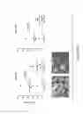Fig. 70 - TREATMENT OF COMPLEMENT-ASSOCIATED DISORDERS