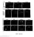 Fig. 72 - TREATMENT OF COMPLEMENT-ASSOCIATED DISORDERS