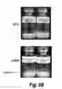 Fig. 14 - METHODS AND COMPOSITIONS FOR CNS DELIVERY OF HEPARAN N-SULFATASE