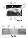 Fig. 03 - CNS delivery of therapeutic agents