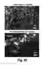 Fig. 35 - CNS delivery of therapeutic agents