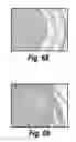 Fig. 47 - CNS delivery of therapeutic agents