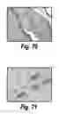 Fig. 48 - CNS delivery of therapeutic agents