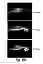 Fig. 72 - CNS delivery of therapeutic agents