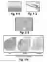 Fig. 75 - CNS delivery of therapeutic agents