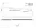 Fig. 09 - Long lasting effect of new botulinum toxin formulations