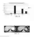 Fig. 15 - MODULATED IMMUNODOMINANCE THERAPY
