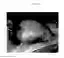 Fig. 02 - Emulsions or microemulsions for use in endoscopic mucosal resectioning and/or endoscopic submucosal dissection