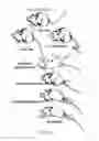 Fig. 03 - AAV-BASED GENE THERAPY FOR MULTIPLE SCLEROSIS