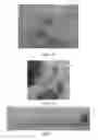 Fig. 10 - Nanoparticle-enabled x-ray magnetic resonance imaging (NXMRI)