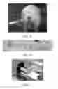 Fig. 13 - Nanoparticle-enabled x-ray magnetic resonance imaging (NXMRI)