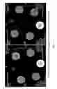 Fig. 15 - Nanoparticle-enabled x-ray magnetic resonance imaging (NXMRI)