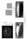 Fig. 30 - Nanoparticle-enabled x-ray magnetic resonance imaging (NXMRI)