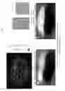 Fig. 32 - Nanoparticle-enabled x-ray magnetic resonance imaging (NXMRI)