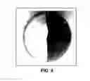 Fig. 05 - Methods for forming scaffolds