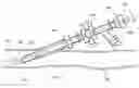 Fig. 01 - Steerable Aspiration Catheter System