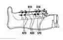 Fig. 01 - WOUND CARE DEVICE