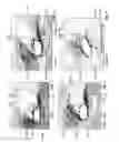 Fig. 04 - Blood pump housing component