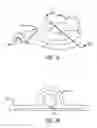 Fig. 04 - Rotary blood pump