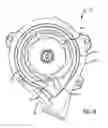 Fig. 15 - Rotary blood pump