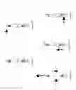 Fig. 08 - Systems and methods for delivery of peritoneal dialysis (PD) solutions with integrated inter chamber diffuser