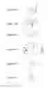 Fig. 13 - Systems and methods for delivery of peritoneal dialysis (PD) solutions with integrated inter chamber diffuser