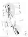 Fig. 02 - ENHANCED CANNULATION METHOD AND NEEDLES