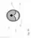 Fig. 09 - ENHANCED CANNULATION METHOD AND NEEDLES