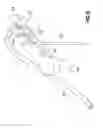 Fig. 06 - Catheter insertion device and method of inserting a catheter