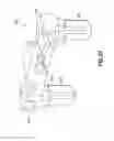 Fig. 37 - Catheter insertion device and method of inserting a catheter
