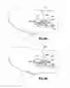 Fig. 48 - Catheter insertion device and method of inserting a catheter