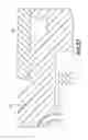 Fig. 59 - Catheter insertion device and method of inserting a catheter