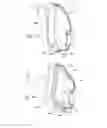 Fig. 04 - Mask system with shroud