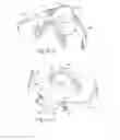 Fig. 69 - Mask system with shroud