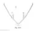 Fig. 76 - Mask system with shroud