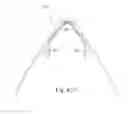 Fig. 77 - Mask system with shroud