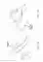 Fig. 33 - Infant calming/sleep-aid, SIDS prevention device, and method of use