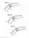 Fig. 05 - ANGLED TIP CATHETER