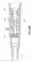 Fig. 40 - Needle capture safety interlock for catheter