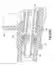 Fig. 45 - Needle capture safety interlock for catheter