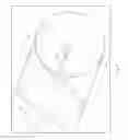 Fig. 05 - Center marker for dilatation balloon