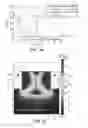 Fig. 07 - Device for inactivating bacteria on the surface of the stratum corneum layer of skin