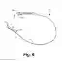 Fig. 08 - Epicardial defibrilation lead with side helix fixation and placement thereof