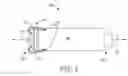 Fig. 04 - INTERVENTIONAL MEDICAL SYSTEMS AND CATHETERS