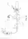 Fig. 08 - INTERVENTIONAL MEDICAL SYSTEMS AND CATHETERS