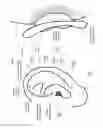 Fig. 02 - Controlling ear stimulation in response to electrical contact sensing