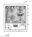 Fig. 40 - User interface with 3D environment for configuring stimulation therapy