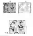 Fig. 44 - User interface with 3D environment for configuring stimulation therapy