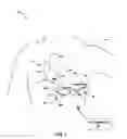 Fig. 02 - Systems and methods for leadless pacing and shock therapy