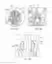 Fig. 08 - Radiosurgical Neuromodulation Devices, Systems, and Methods for Treatment of Behavioral Disorders by External Application of Ionizing Radiation